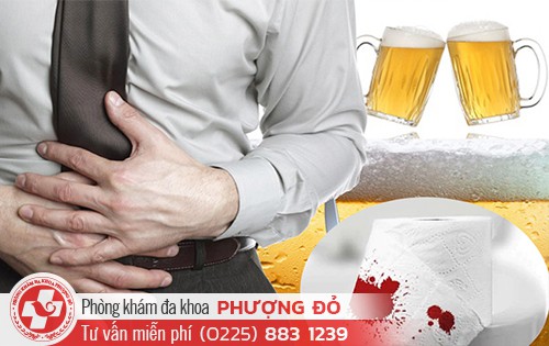 Mắc bệnh trĩ có uống bia được không? Chuyên gia giải đáp