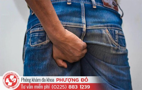 Nấm hậu môn: Nguyên nhân, dấu hiệu và hướng điều trị an toàn