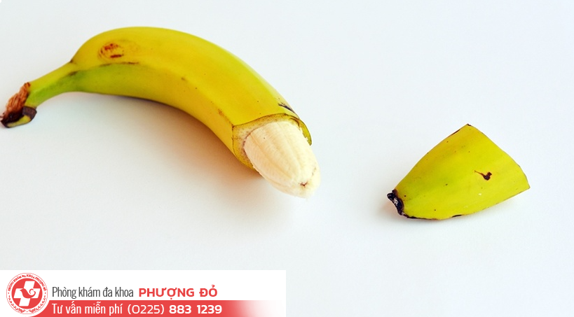 Có nên cắt bao quy đầu trước khi lấy vợ không?