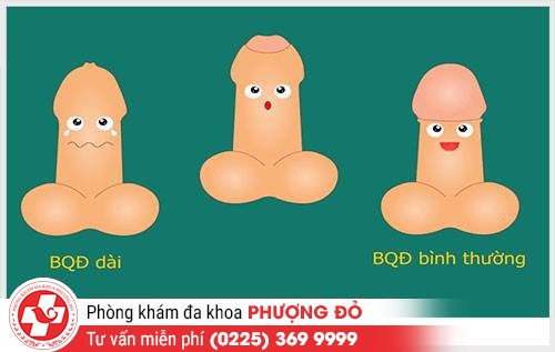 Dấu hiệu dài bao quy đầu ở nam giới đáng lưu ý