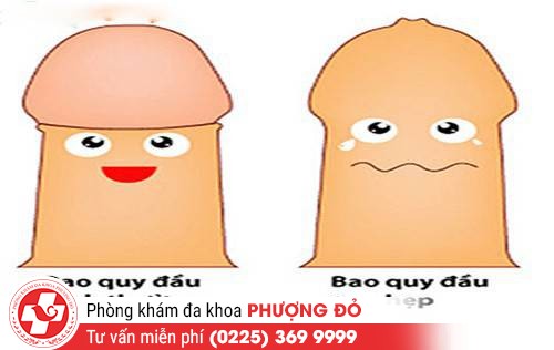 Nguyên nhân hẹp bao quy đầu
