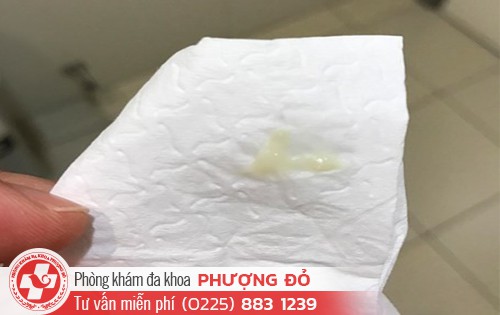 Khí hư màu xanh như nước mũi là bệnh gì?