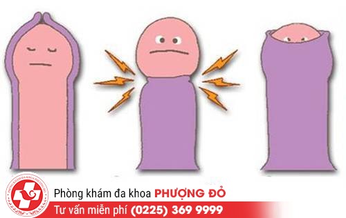 Quan hệ tình dục bị chảy máu do hẹp bao quy đầu