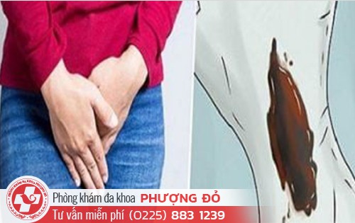 Vùng kín bị ngứa và ra dịch màu nâu
