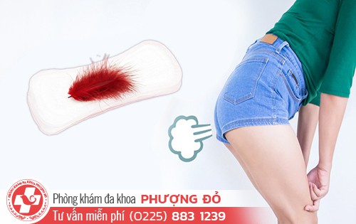 Xì Hơi Khi Có Kinh