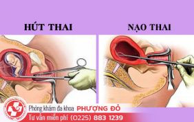 nao-hut-thai-la-gi-nhung-dieu-kieng-ky-sau-khi-nao-hut-thai