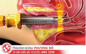 phuong-phap-thu-hep-am-dao-hieu-qua-nhat-2017
